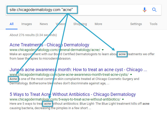 Find internal link opportunities via Google search